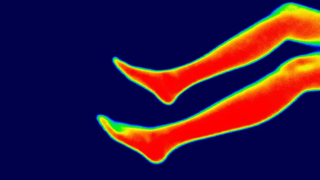 eine Wärmebildmessung zweier Beine