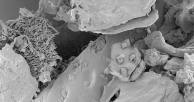 Nahaufnahme eines Elektronenmikrospkop